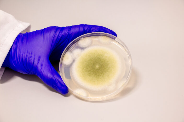 Mẫu nấm Aspergillus flavus được nuôi cấy trong phòng thí nghiệm Gao. (Ảnh: Bella Ciervo)